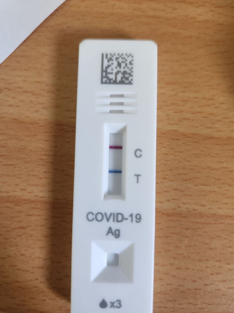 Way too enthusiastic covid-19 test response showing dark C and T lines...
