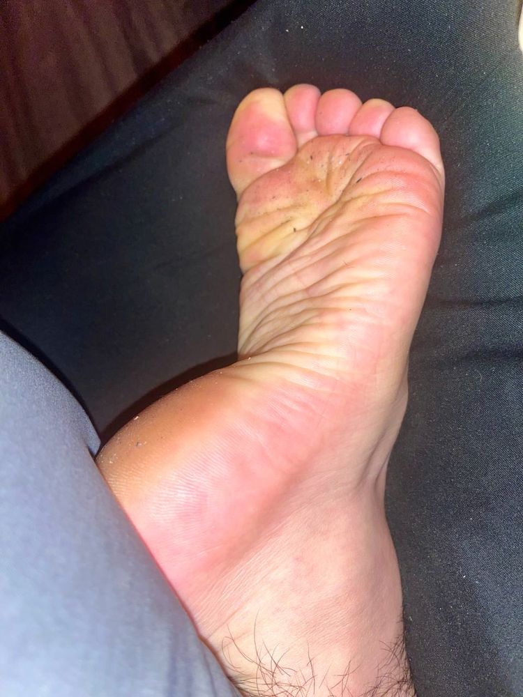 Picture of a dirty foot.