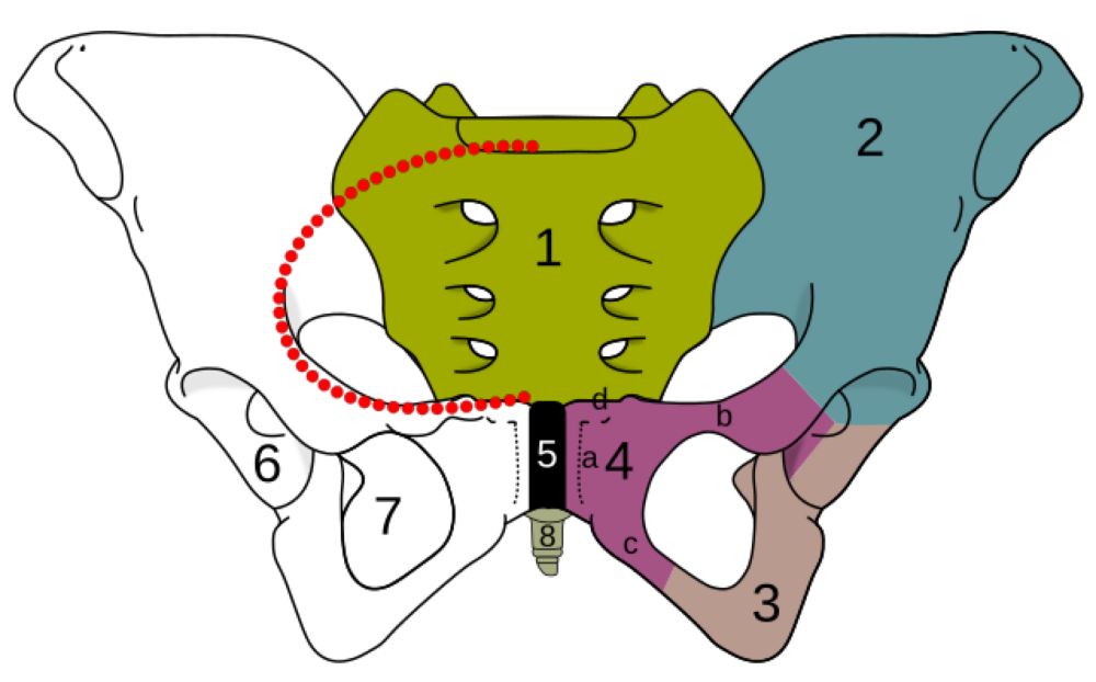 Symphysiotomy - Wikipedia