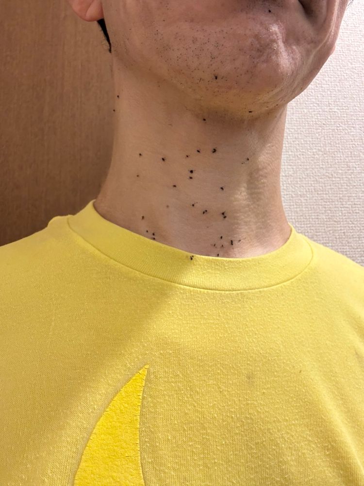 首筋にたくさんの小さな虫がぶつかって黒い点々が付いている