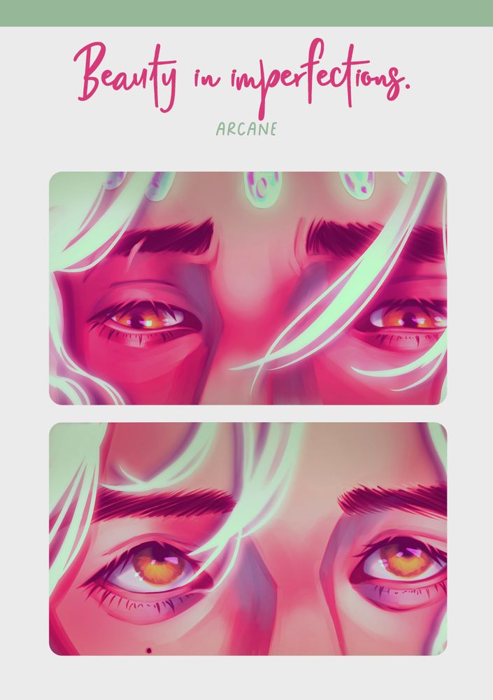 Imagem ilustrativa do kit de bottons de Jayvik, ship de Arcane composto por Jayce e Viktor. São dois bottons estreitos, horizontais. O primeiro deles traz os olhos de Jayce — um rapaz de pele bronzeada, com olhos cor de mel, algumas digitais brilhantes impressas em sua testa e cabelos esvoaçando, em um branco esverdeado brilhante. O olhar de Jayce é suave, carinhoso, direcionado ao personagem cujos olhos estão no botton inferior. Este personagem é Viktor — um rapaz pálido, de olhos amarelos, uma pinta do lado esquerdo, sob seu olho, e cabelos igualmente esvoaçantes, branco-esverdeados e brilhantes. Ele encara Jayce de volta. Acima dos bottons, há os dizeres em inglês: “Beauty in imperfections”
