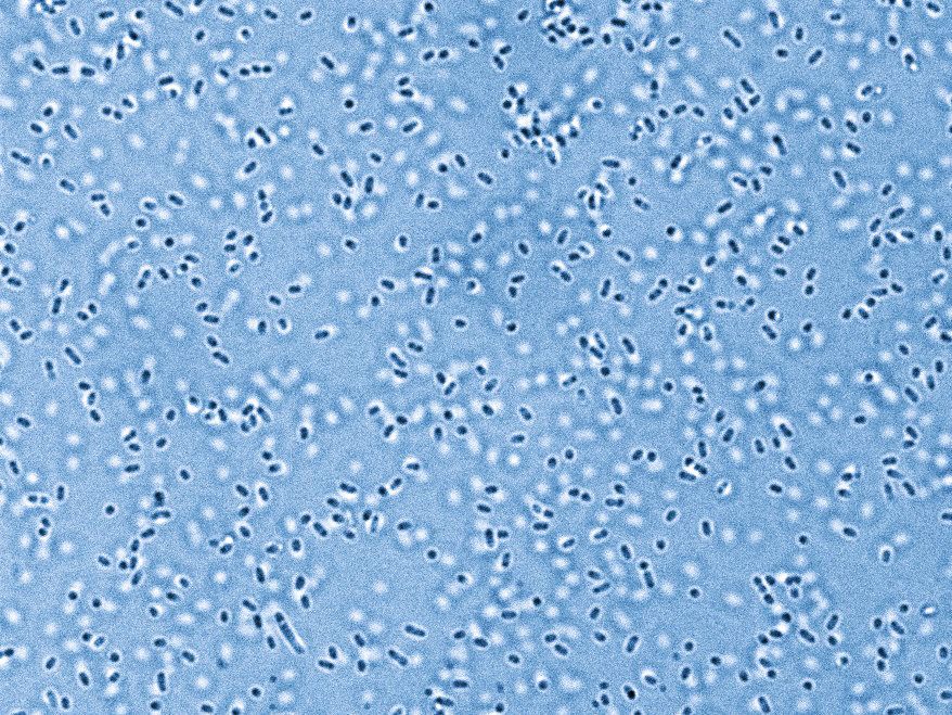 Blue-colored scanning electron micrograph shows numerous oval bacterial cells of Pandoraea sputorum in dense distribution.