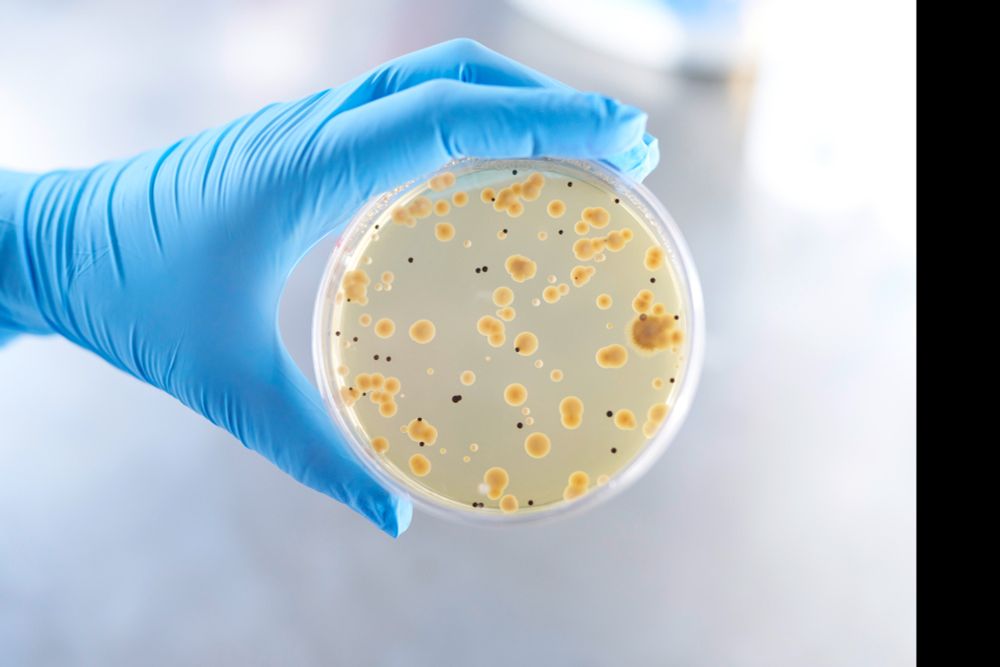 The image shows a Petri dish containing microbial colonies of yellowish color growing on an agar medium. A gloved hand is holding the dish, likely in a laboratory setting. The different colors and shapes of the colonies suggest the presence of multiple microbial species, possibly being cultured for research, diagnostics, or pharmaceutical purposes.