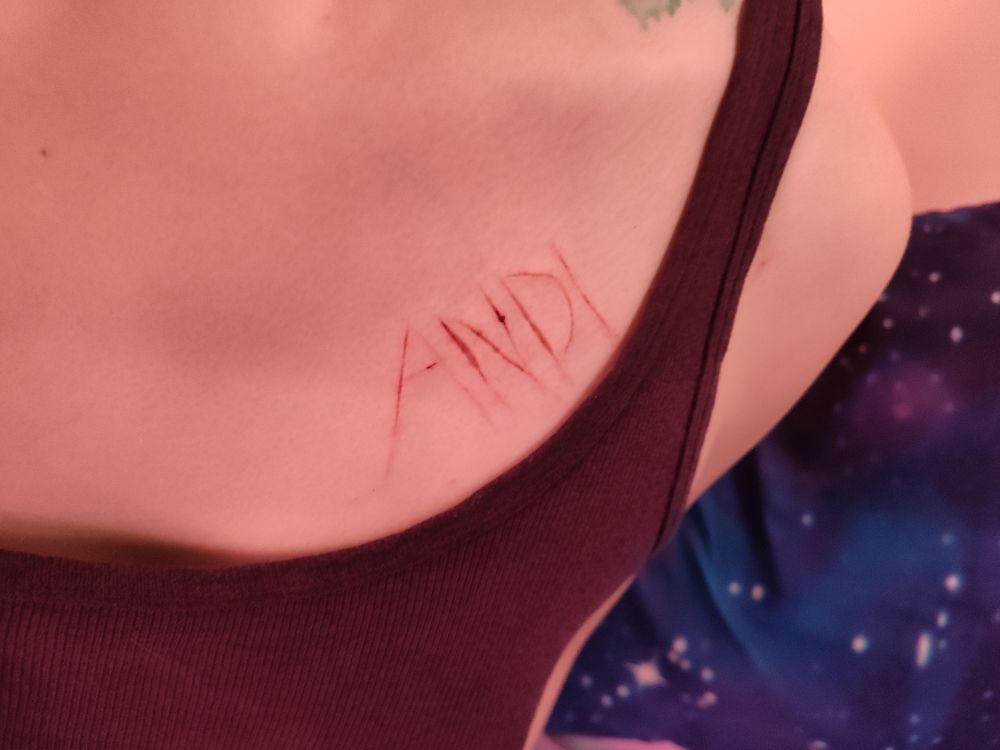 CW: Blood.

Wilde (Andi's boyfriend)'s chest, with "ANDI" cut into his skin. The wound has healed over the course of a day, but is still fairly fresh.