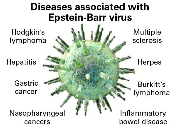 Epstein Barr Virus and causes of disease