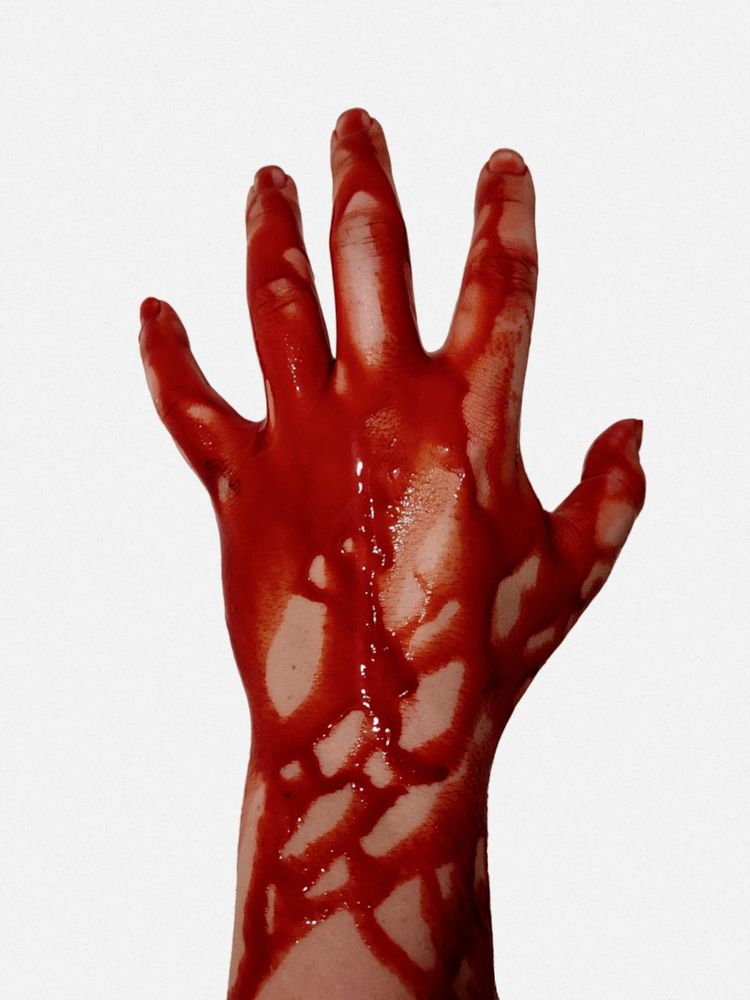 A photograph of Asheroth's hand coated in blood.