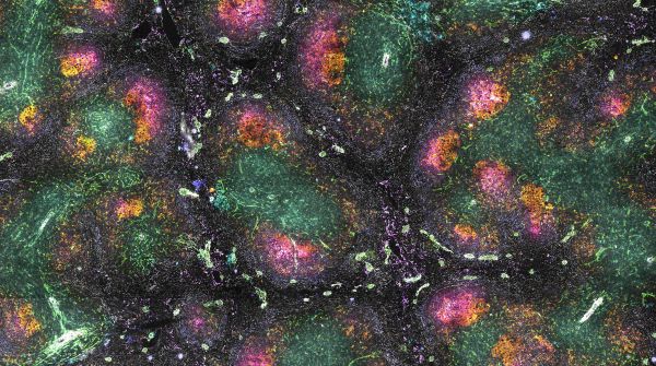 An image that looks like a galaxy. The spleen is an organ of the lymphatic system that plays an important role in the immune system. In this video, multiple markers were used to characterize the structure of the germinal centres in the spleen. 25 different cellular markers were targeted including B cells, T cells, plasma cells, fibroblasts, macrophages, stromal cells, granulocytes, red blood cells and dendritic cells. Images were taken by using the ultra-high content MACSima imaging platform at the Imaging Facility by Isabel
