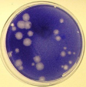 Picture of a plaque assay (purple field with clear holes) showing gorgeous poliovirus plaques