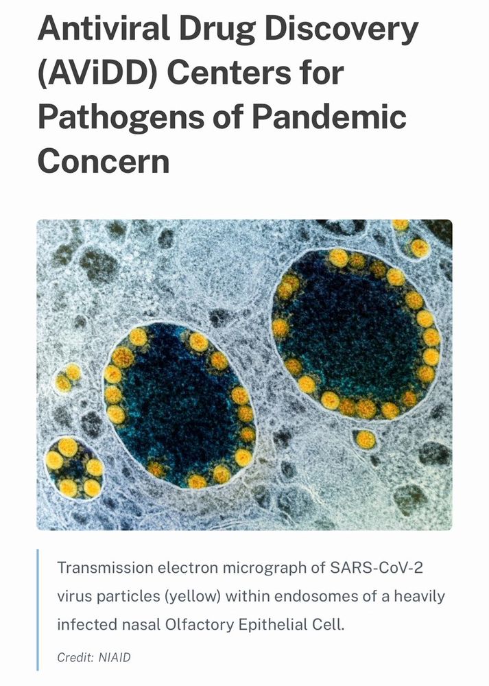 Antiviral Drug Discovery (AViDD) Centers for Pathogens of Pandemic Concern

(TEM image)



Transmission electron micrograph of SARS-CoV-2 virus particles (yellow) within endosomes of a heavily infected nasal Olfactory Epithelial Cell.
Credit: NIAID
