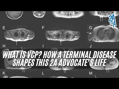 2A for All: What Is VCP? How a Terminal Disease Shapes This 2A Advocate’s Life