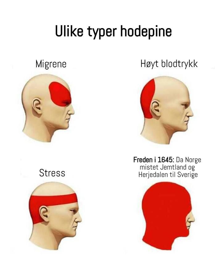 Et skjema med overskriften "ulike typer hodepine". Illustrasjonen viser fire hoder med rødt markert ulike steder. Markert bak øynene har teksten "migrene". Markert i bakhodet har teksten "høyt blodtrykk". Bakhodet og et bånd rundt pannen har teksten "stress". Så godt som hele hodet rødt unntatt nese og munn har teksten "Freden i 1645: da Norge mistet Jemtland og Herjedalen til Sverige".