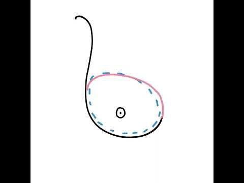 Breast Reconstruction Overview