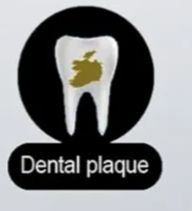 A zoomed in image of the dental plaque tooth with the icon of the Republic of Ireland symbolising the plaque. 