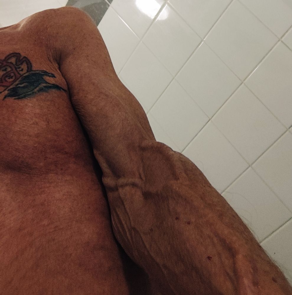 Le bras gauche d' homme et une partie du torse avec un tatouage en forme de coeur figurant le logo de l' association monégasque pour la lutte contre le sida. Sur le bras gauche une grosse veine apparente prête à recevoir la dialyse qui commencera bien un jour.