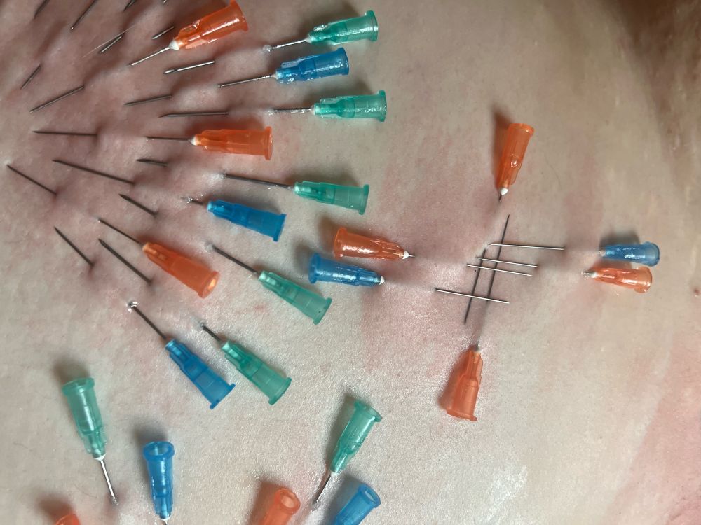 One final detail shot that includes a crosshair pattern 