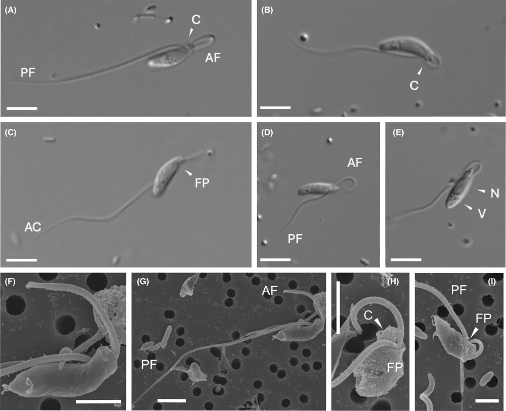 Morphology of Allobodo yubaba n. sp. 