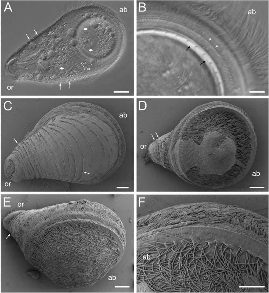 Light and scanning electron micrographs (SEM) of Urceolaria clepsydra n. sp. found in sea cucumbers.