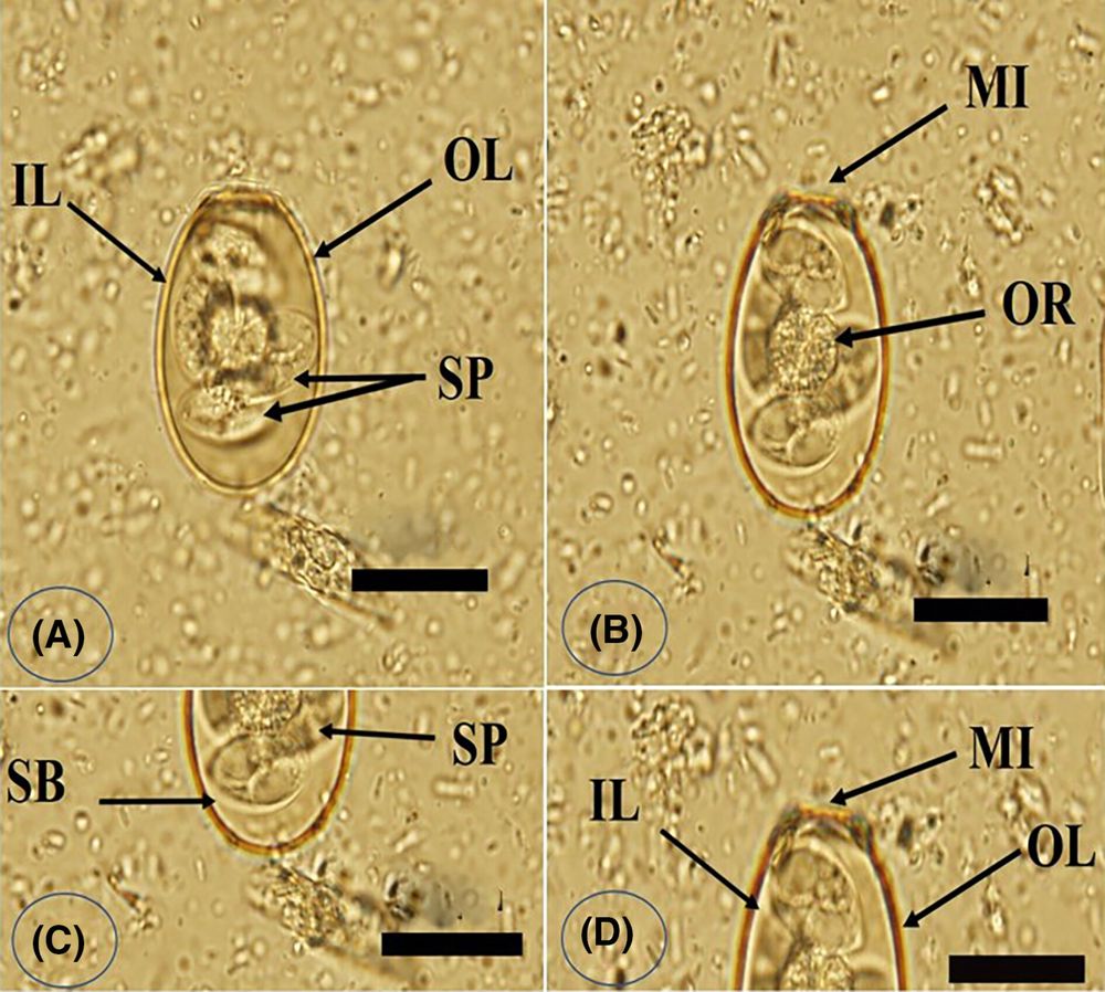 Photomicrographs of Eimeria magna oocysts