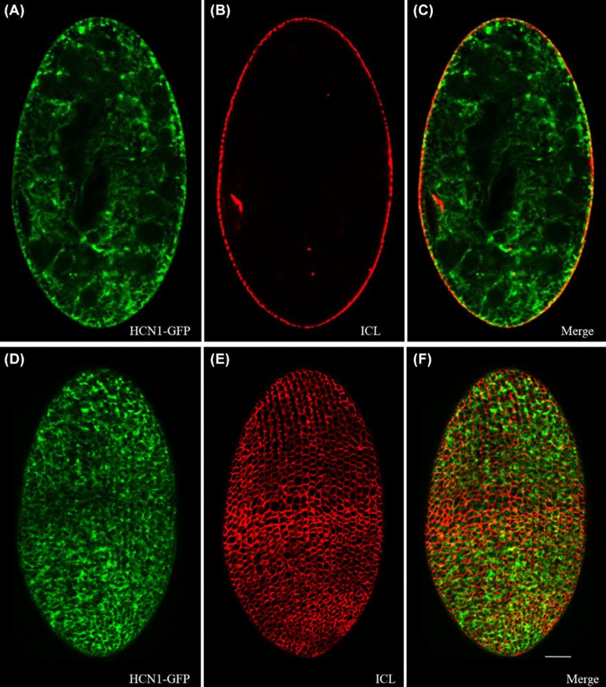 Localization of HCN1-GFP in Paramecium tetraurelia. 