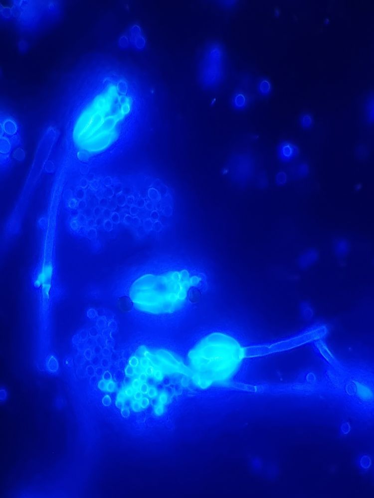 Marine fungi conidiophores with calcofluor white stain