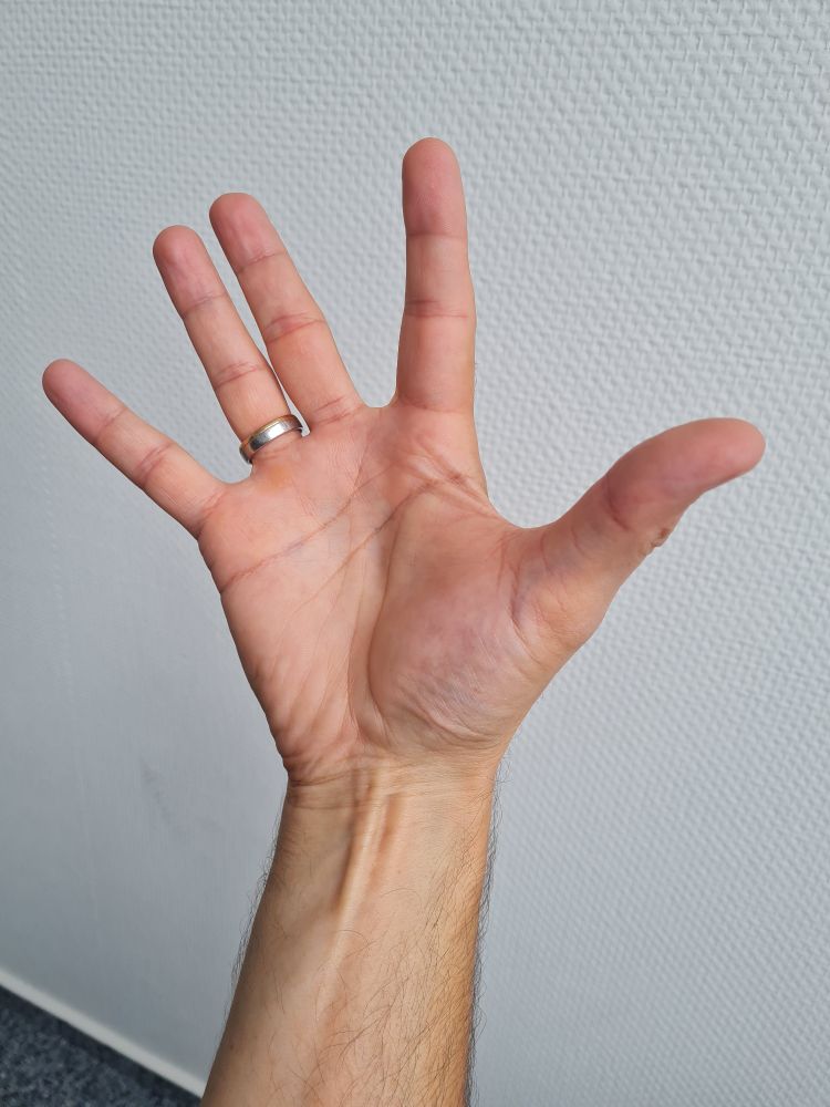 Meine Hand vor einer weißen Wand 