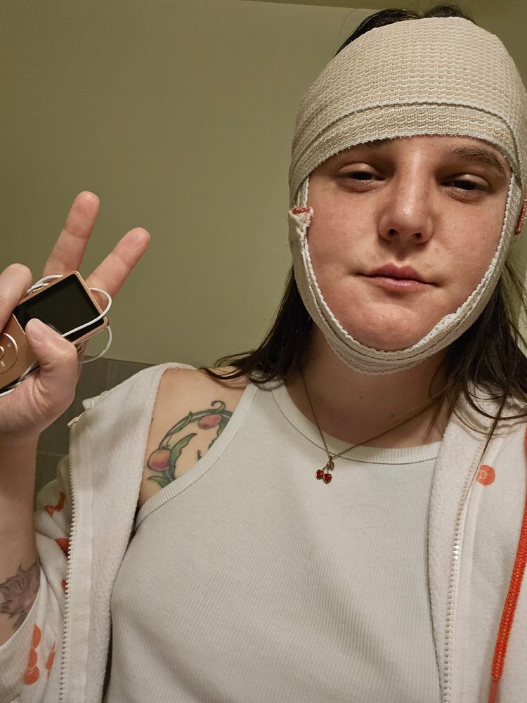 Jamie has an ace bandage around her head