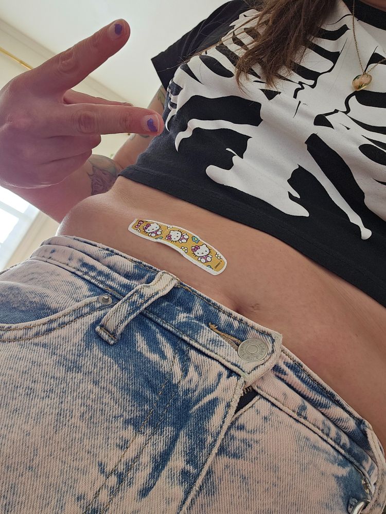 A picture of a woman's stomach under a cropped skeleton shirt. A hello kitty bandage is visible on her tum.