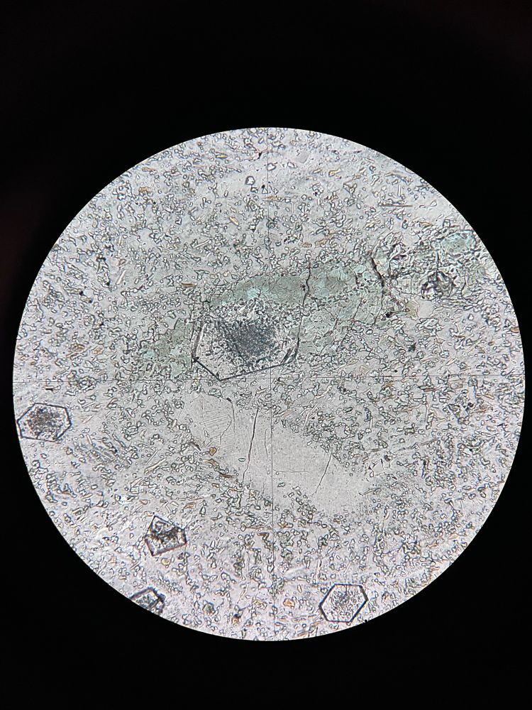 Plane polarized light micrograph of a pseudotachylyte
