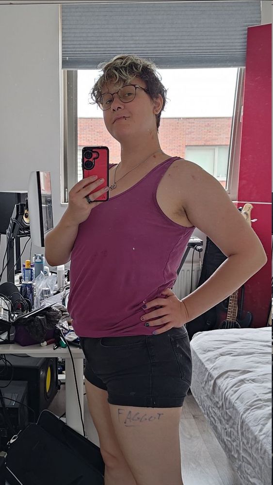 Mirror selfie of me standing. You can read the word "faggot" written on my leg, right where my shorts end. There are also plenty of hickeys on my neck.