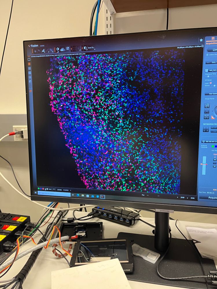 Microscopy image of an organoid on a computer screen