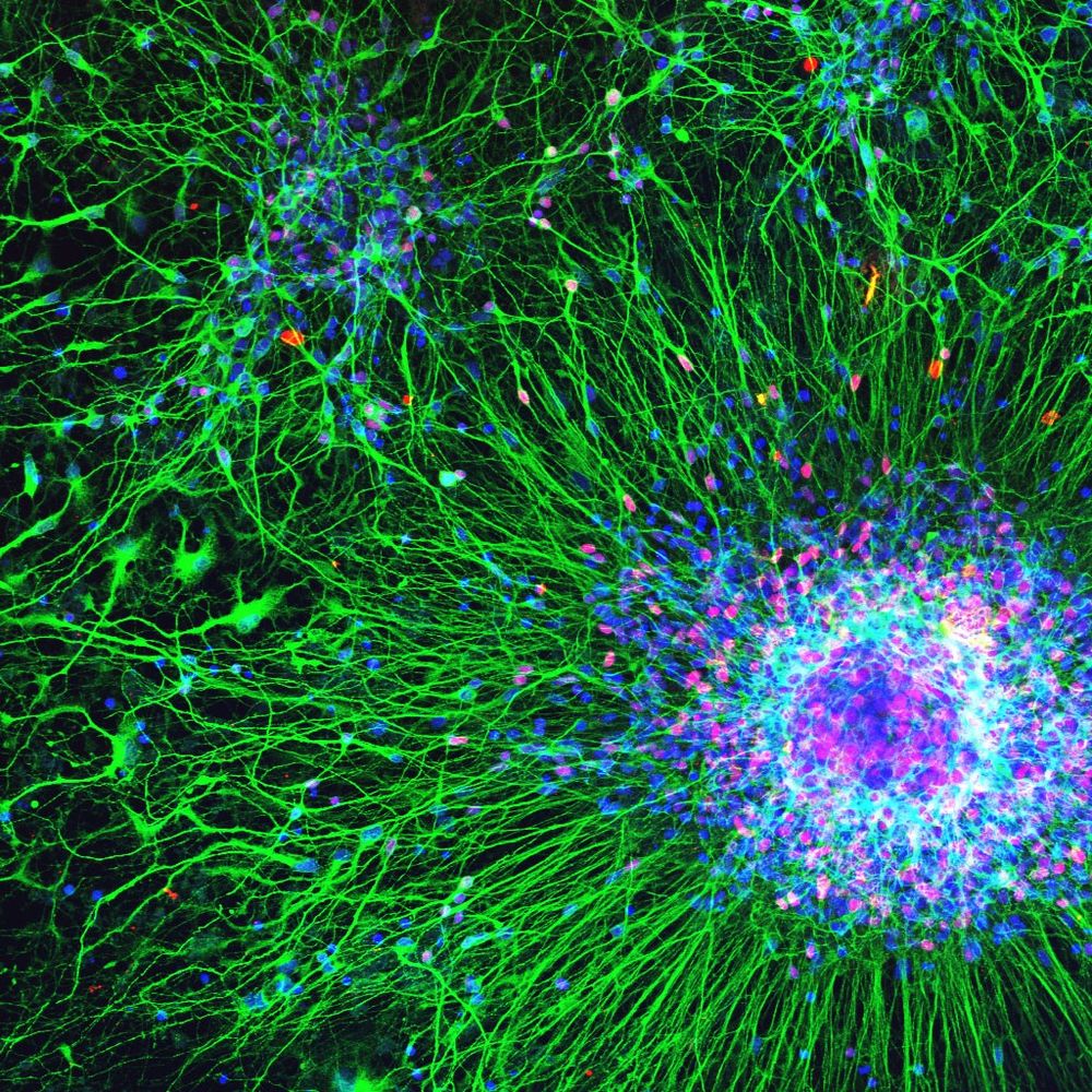 human neurons grown in vitro