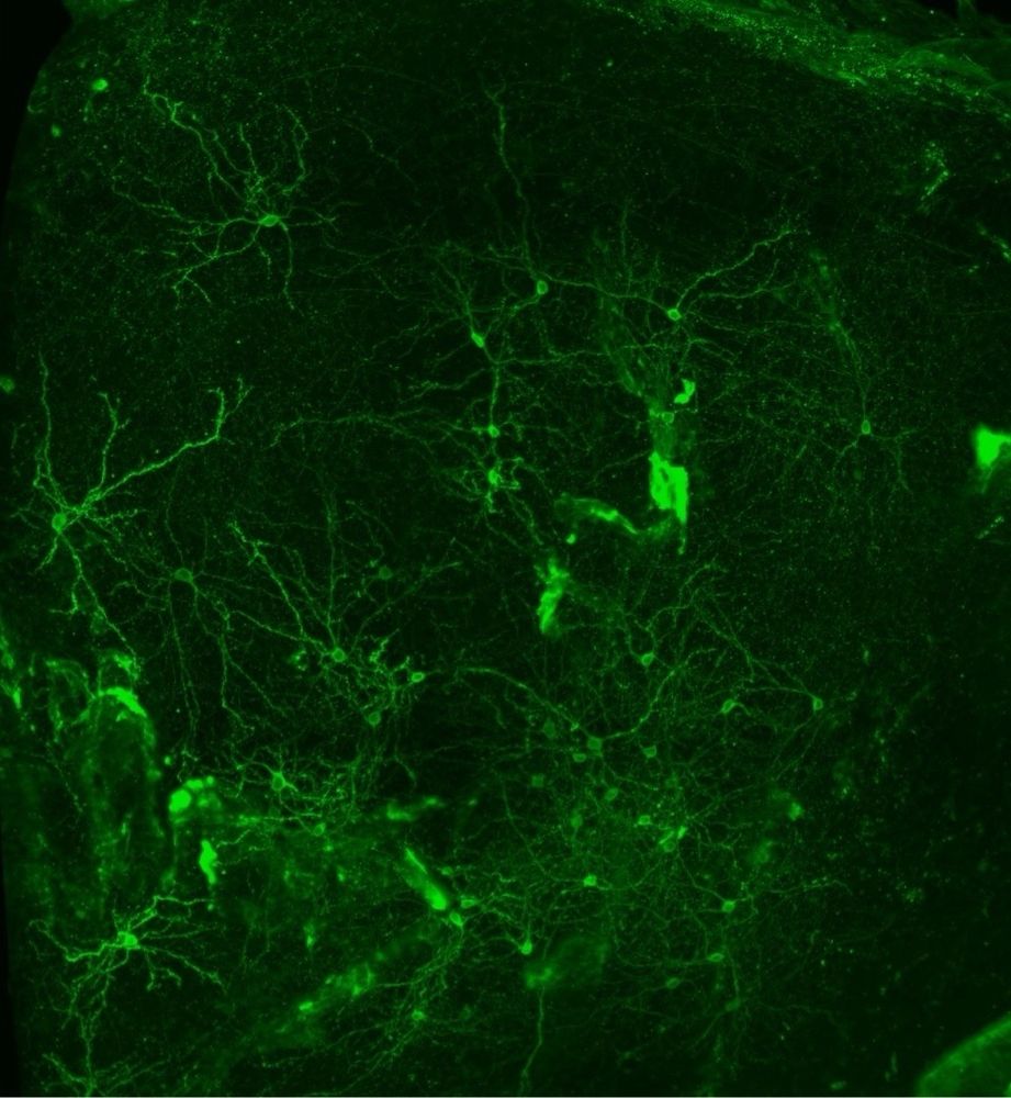 Fluorescent images of green neurons