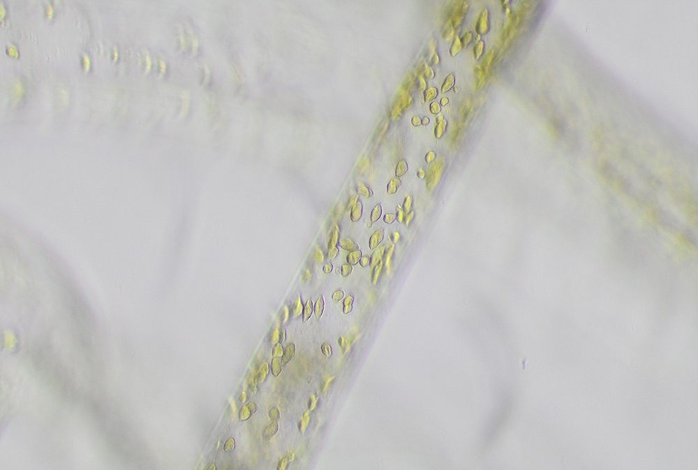 Phase contrast microscopy image showing the chloroplast morphology of siphonous green algae.