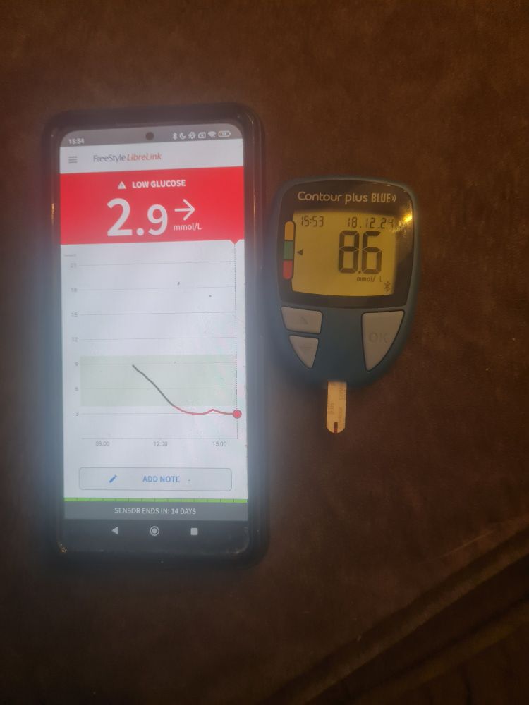 Smartphone with Abbott Healthcare LibreLink app showing a dangerously faulty reading of 2.9 mmol/l blood sugar,  compared with a BGM showing 8.6 mmol/l. 