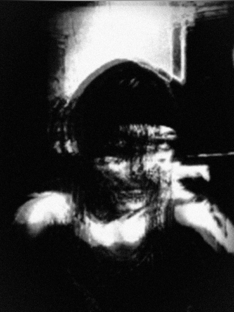 Picture of myself, black and white. Face melting/peeling effect but it's vague due to the way in which the picture is edited.