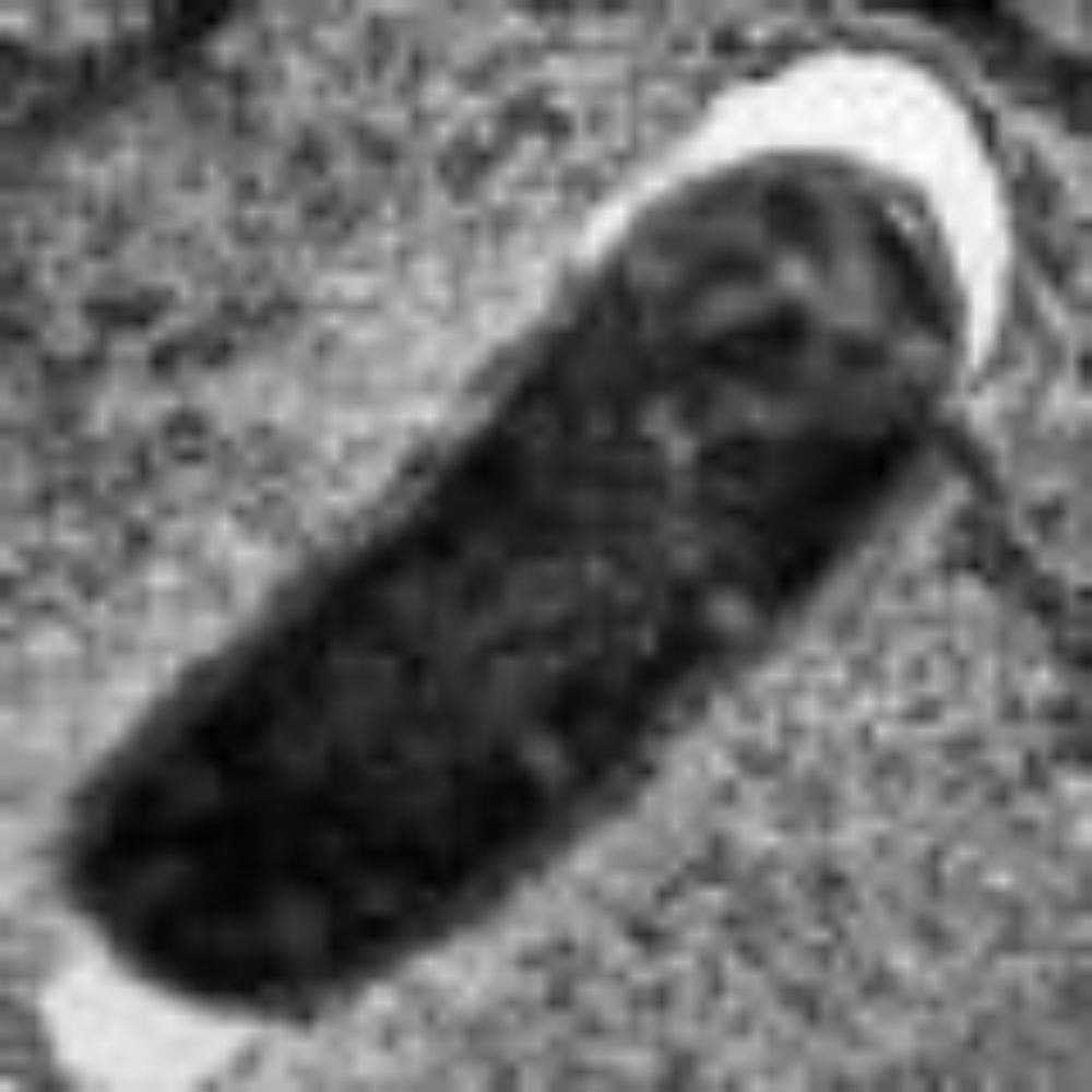 The Florida Department of Health said on Monday that there have been 21 cases of Campylobacter and E. coli infections linked to drinking raw milk in the state, including six children under 10.