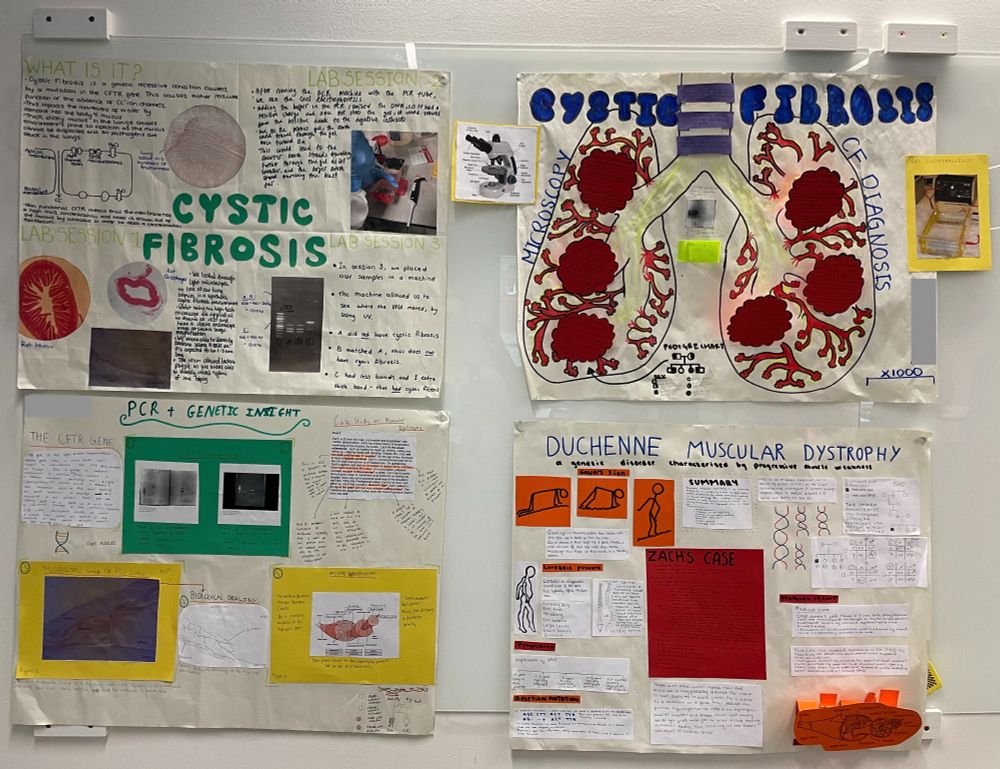 Four hand-made posters on a wall. Two are about cystic fibrosis, one is about Duchenne muscular dystrophy and one about diagnosis of genetic diseases.