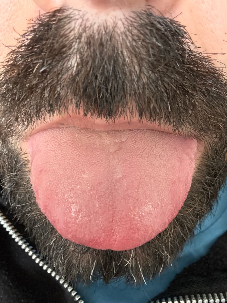 Comment image