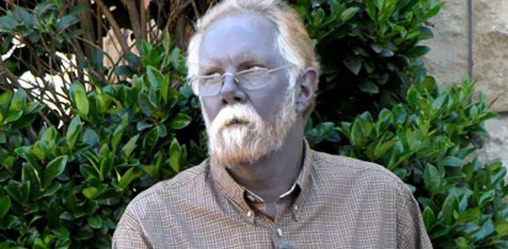 image of a man who, through consumption of a certain fish antibiotic, turned himself blue
