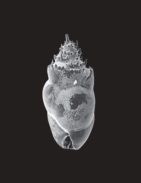 SEM image of a benthic foraminifera. 