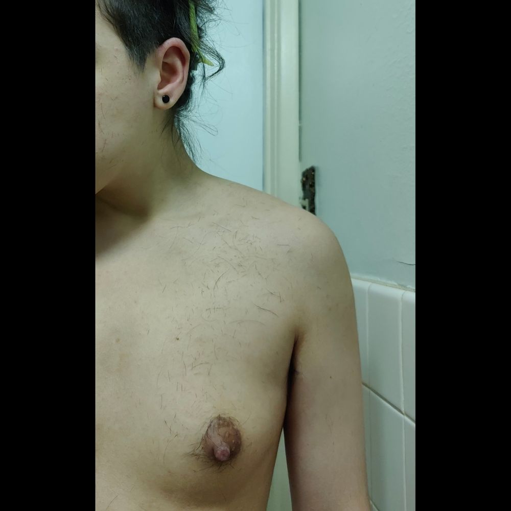 my freshly-shaven sidecut. loose, dark-colored hair trimmings are scattered all over the side of my face and my bare upper body. one of my small breasts with soft, puffy nipples is in frame.