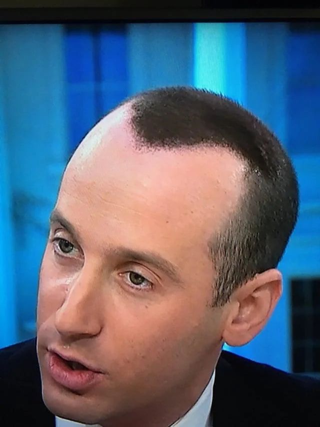 Stephen Miller's forehead looks like it's covered in black mold.