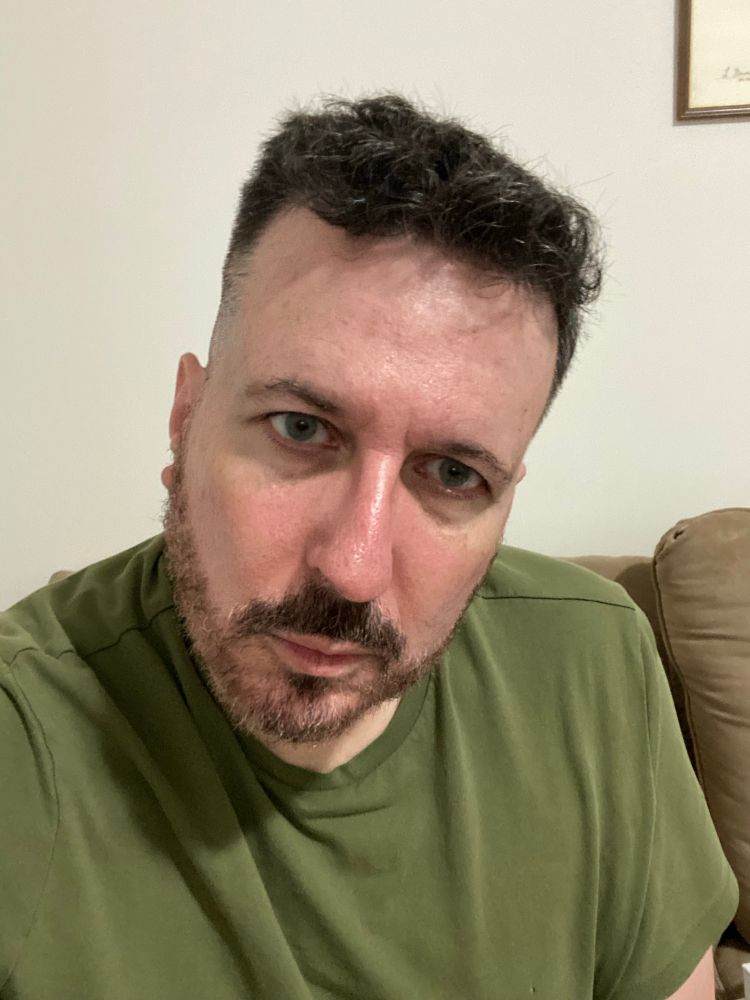 A picture of me with my contact lenses in.