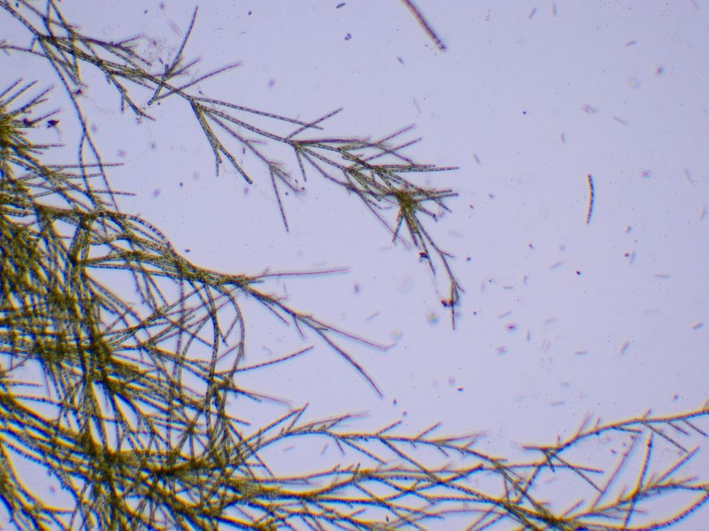 Photo of branched algae seen under microscope.