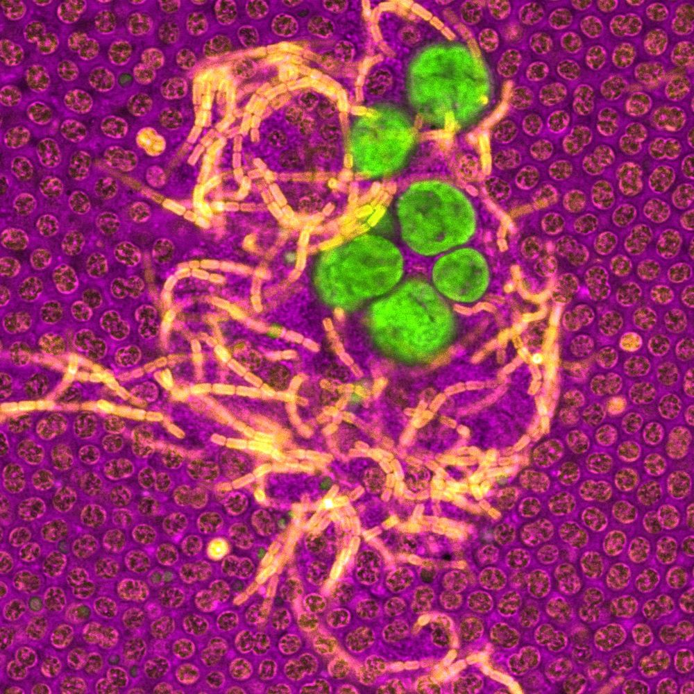 Background of magenta circles packed into one layer. In the middle of the image, we see yellow filaments made up of rectangular cells surrounding five large green cells.