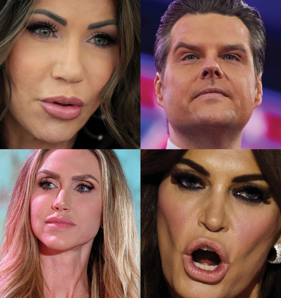 Kristi Noem, Matt Gaetz, Kimberly Guilfoyle, and Lara Trump after face surgery