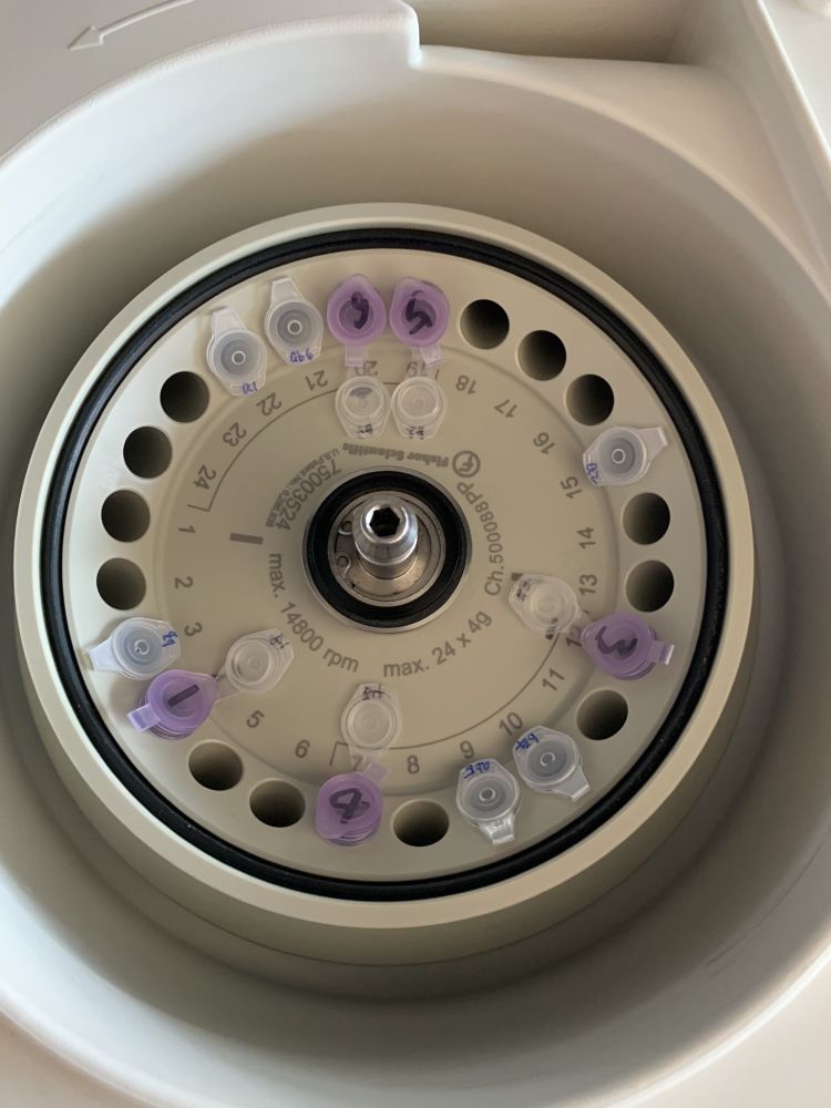 a pic of tube arrangement of 11 tubes in the centrifuge but it did not look balanced at all (although it is). the 11 tubes were broken down into 3+2+6 groups and within each group it's perfectly balanced on its own.