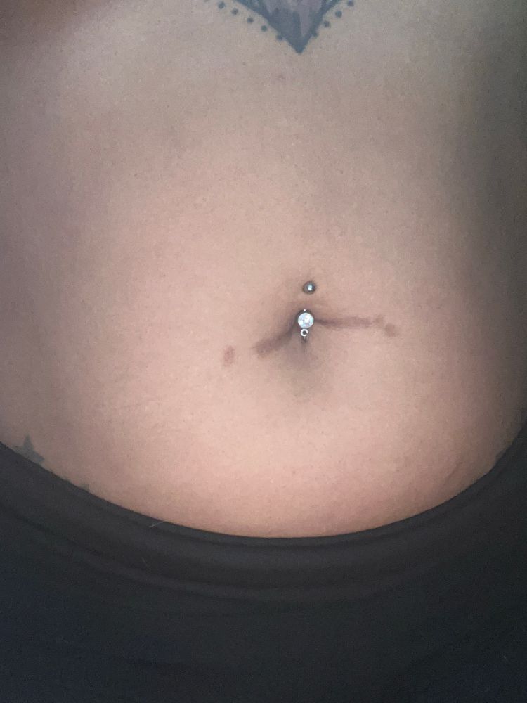 Pierced belly button with scars extending out to the left and right