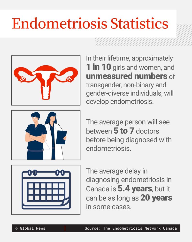 Endometriosis Statistics
Approx 1 in 3 will develop endometriosis 
Avg person will see 5-7 dr before diagnosis 
Avg delay of diagnosis is 5.4 yrs and as long as 20 yrs