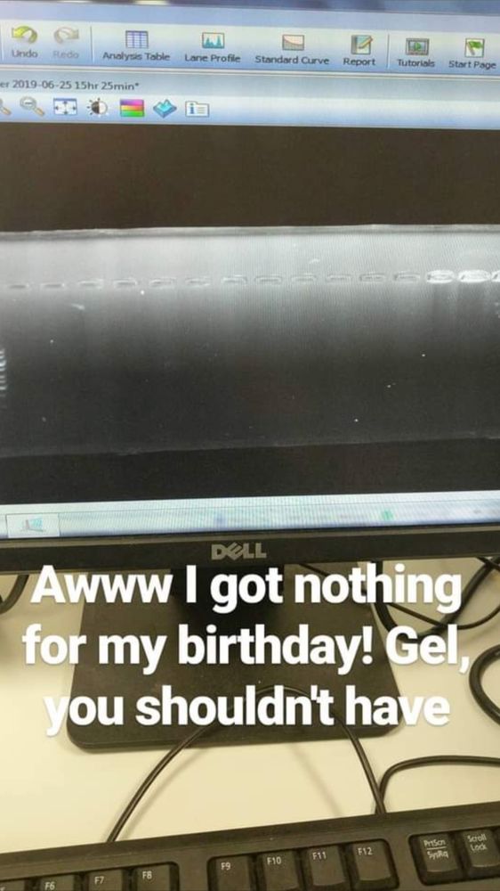 A gel for electrophoresis with no highlights except for the control ladder. With the caption "Aww I got nothing for my birthday! Gel, you shouldn't have!"